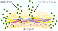 歯の表面 4