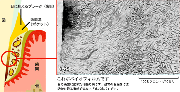 これがバイオフィルムです