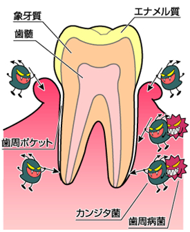 歯周病 大阪 東大阪で評判の歯周病治療専門歯科 歯周病の基礎知識 歯周病とは