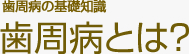 歯周病の基礎知識 歯周病とは？