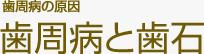 歯周病の原因 歯周病と歯石