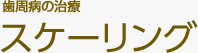 歯周病の治療 スケーリング