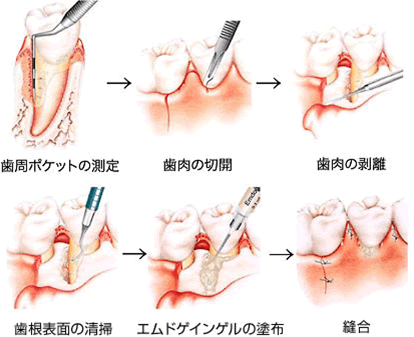 エムドゲインとは？ イメージ
