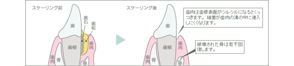 スケーリング前後比較図